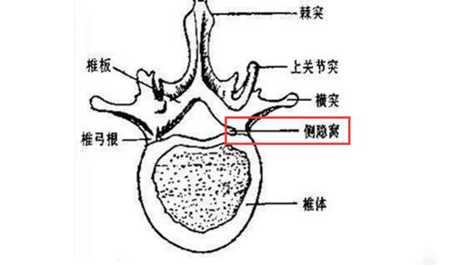 椎体侧隐窝图片