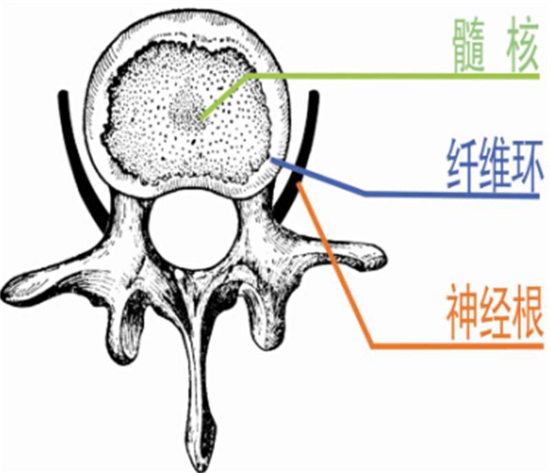 正常的椎间盘和神经根.jpg