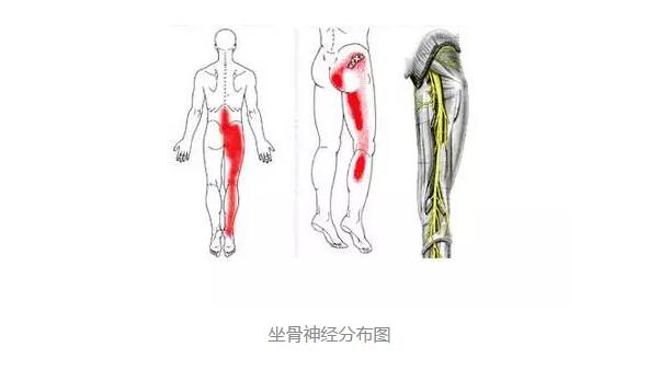 坐骨神经分布图